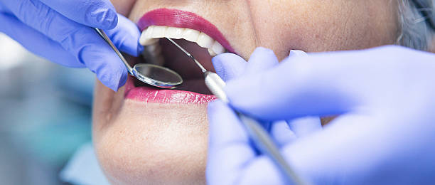 Best Emergency Dental Care for Broken or Chipped Teeth in Flower Hill, NY